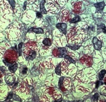 Mycobacterium leprae