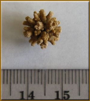 Urolith bladder stone